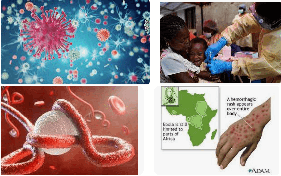 Ebola Virüsünün Görüldüğü Ülkelerdeki Karantina Uygulaması, Hangi Hakların Kullanılmasını Engellemektedir Yazınız.